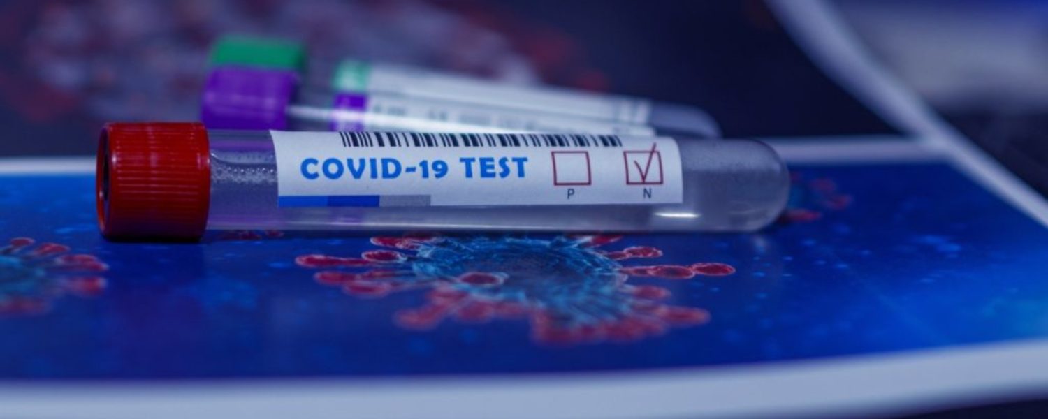 tests-covid19-epidemie-de-cas-2