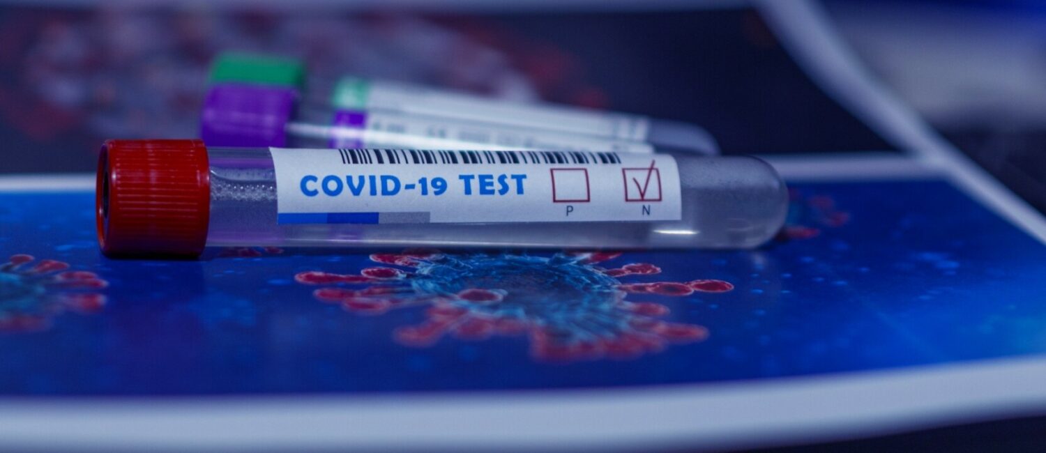 tests-covid19-epidemie-de-cas-2