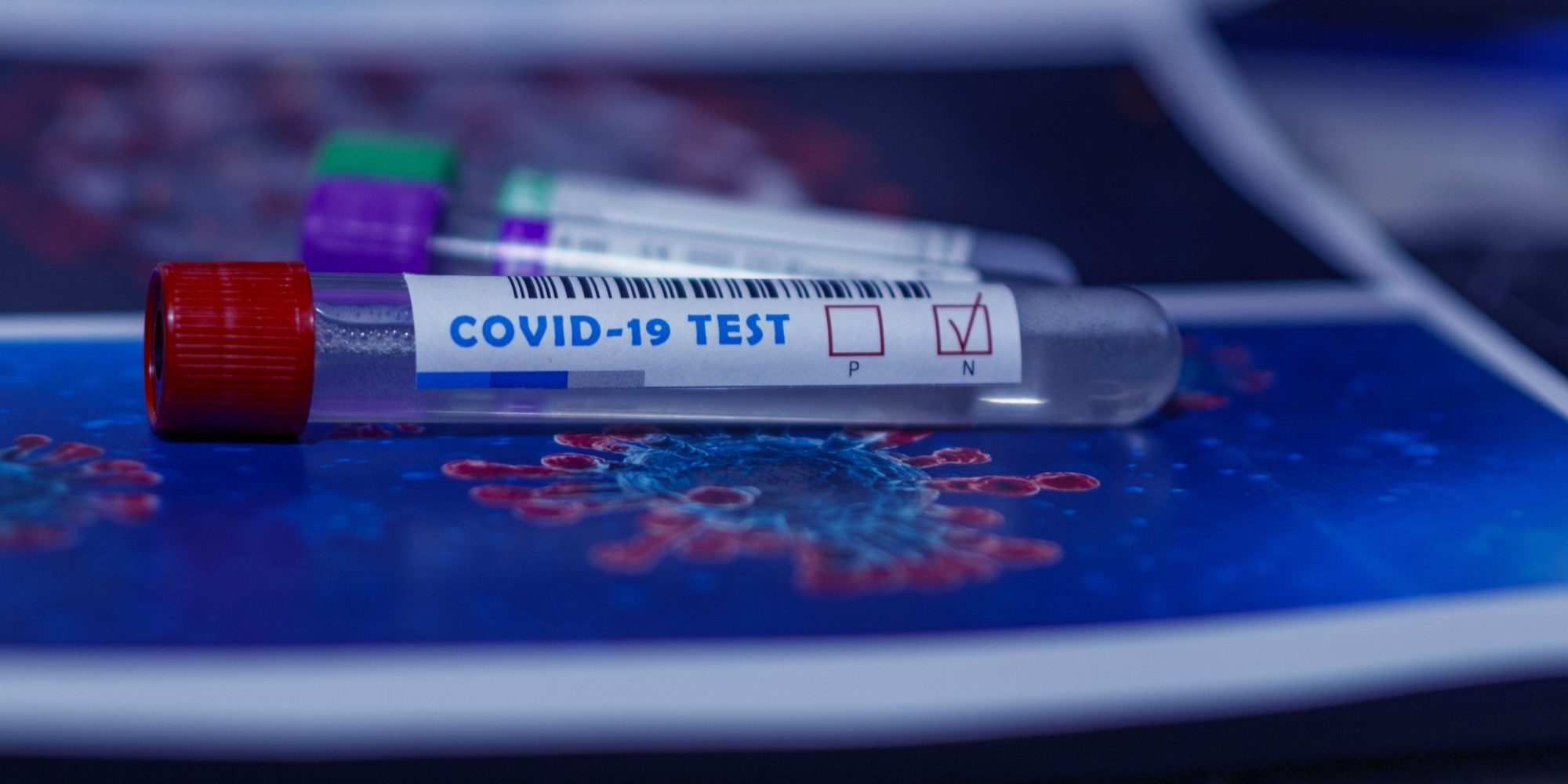 tests-covid19-epidemie-de-cas-2