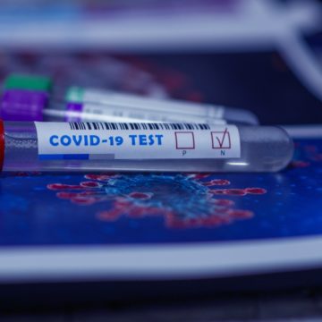 tests-covid19-epidemie-de-cas-2