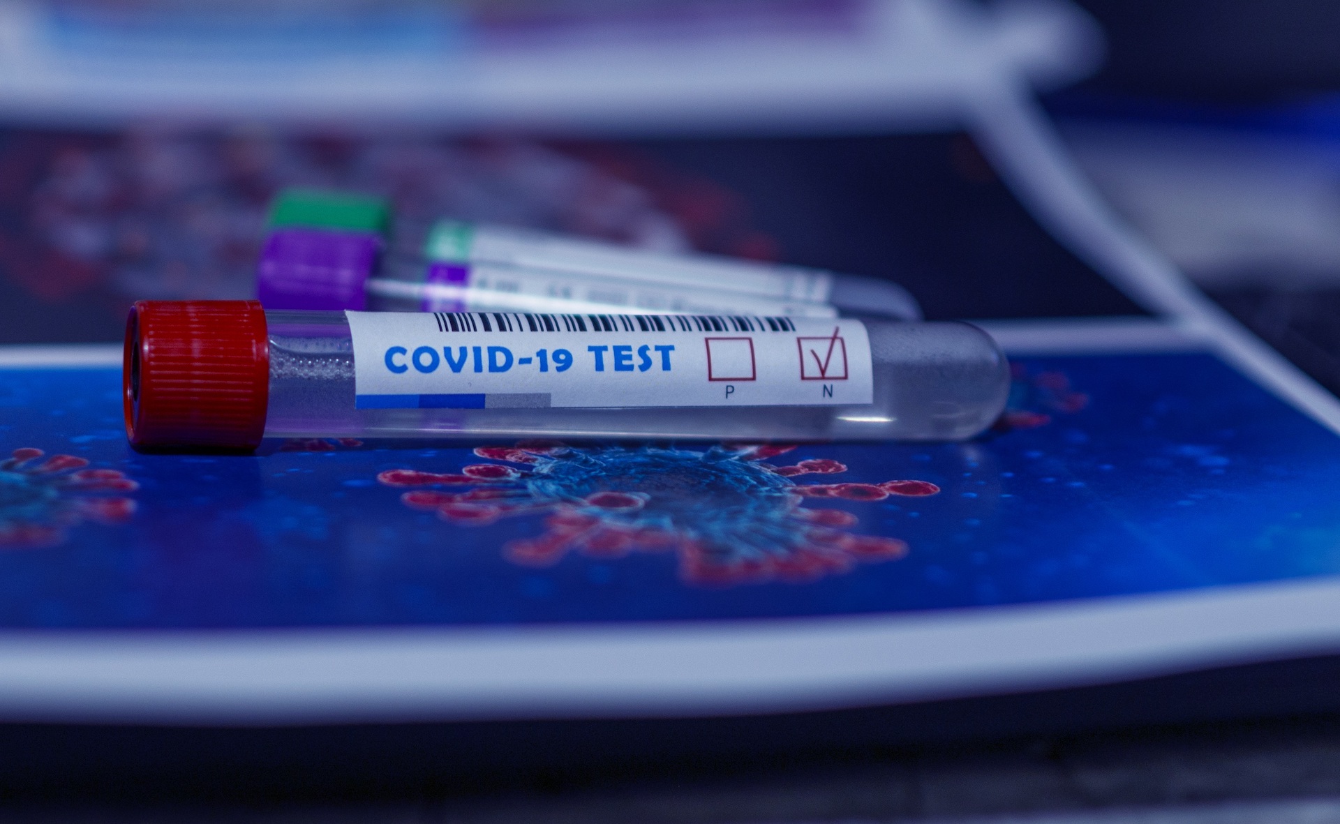 tests-covid19-epidemie-de-cas-2