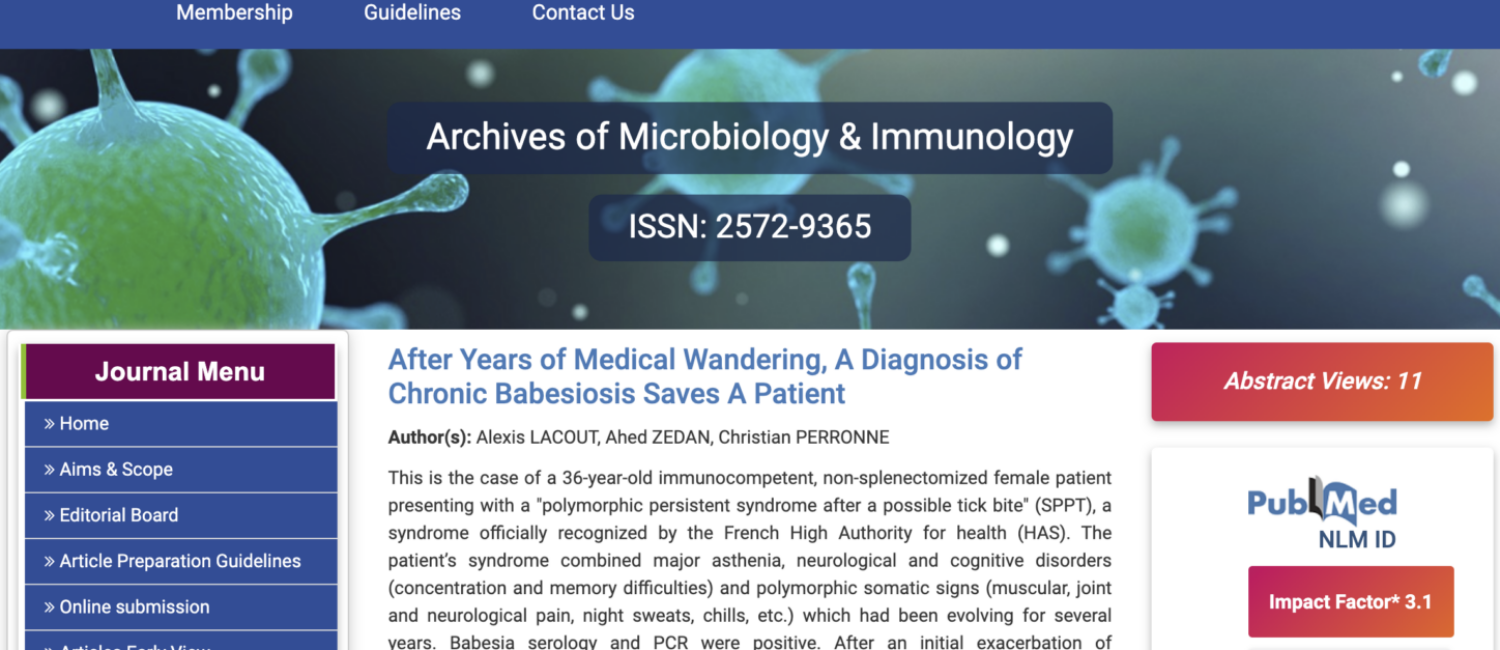 diagnosis-babesiosis