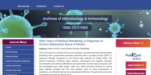 diagnosis-babesiosis